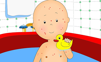 Caillous New Adventures S01E22 Caillou gets Chicken Pox